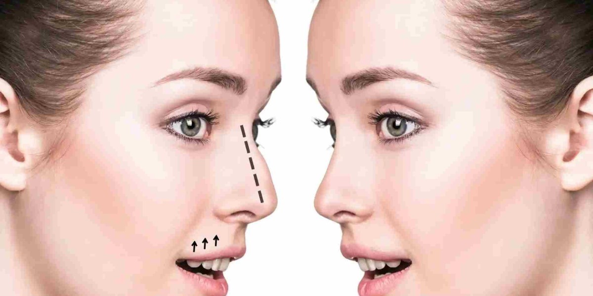 Best Septoplasty Surgeon in Dubai for Nasal Septum Correction